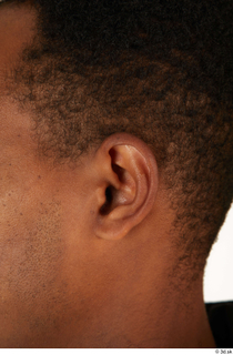 Photos of Jamaal Parsa ear 0001.jpg